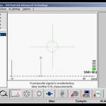 Pre-operative Assessment of Cataracts