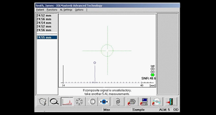 Pre-operative Assessment of Cataracts